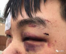 中国留学生遭围殴 被斥&quot;滚回中国&quot;