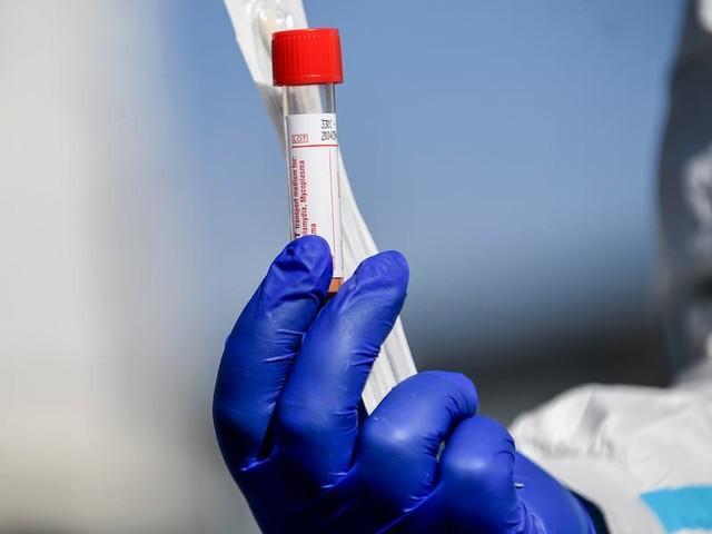 抗疫曙光！牛津大学给恒河猴注射新冠疫苗，28天暴露病毒中未感染