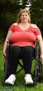 英国前女运动员胸部太大压垮脊柱，坐轮椅4年痛