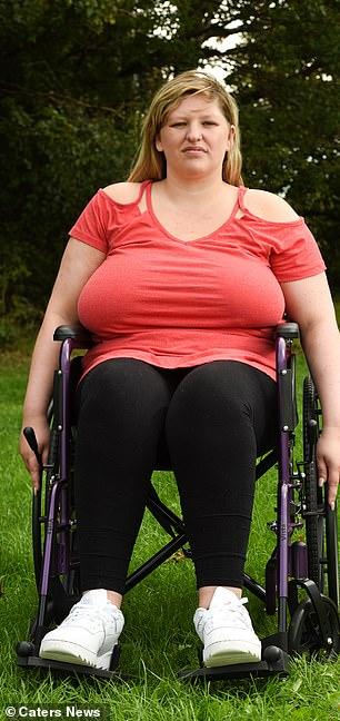 英国前女运动员胸部太大压垮脊柱，坐轮椅4年痛苦不堪，只盼缩胸