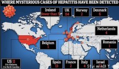 英国114例！罕见儿童肝炎在欧美传播，10多个儿童急需肝移植