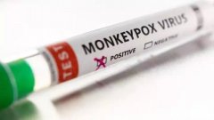 猴痘疫情蔓延 瑞士罗氏药厂研发出快筛试剂