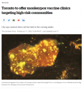 多伦多为高风险社区提供猴痘疫苗接种
