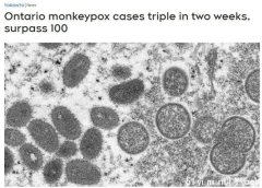 安省猴痘病毒2周飙3倍 很像新冠