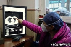 中国肺部CT检查暴增 专家:实际检出率约10%-20%