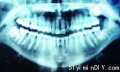 安省索取牙医纪录暴增4倍 专家指与追查陈年旧案有关(图)